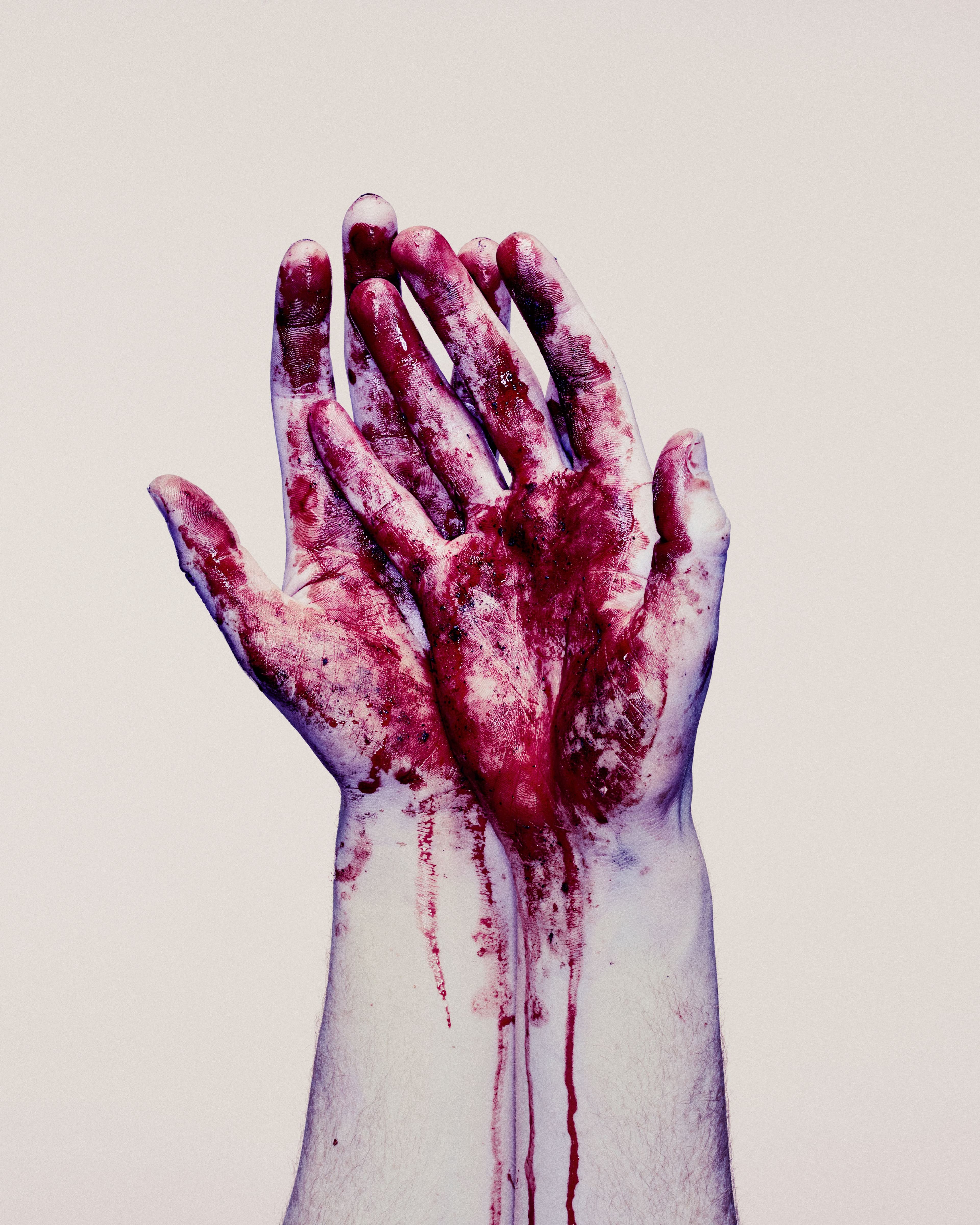 bloody hands