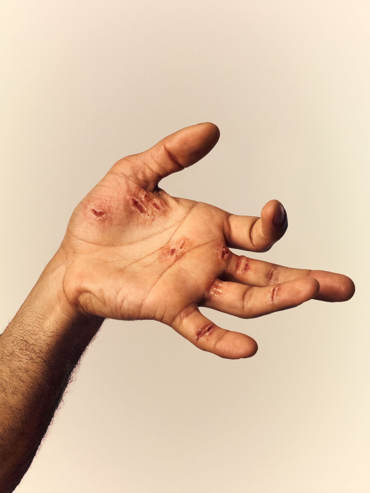 a mans hand with cuts on it