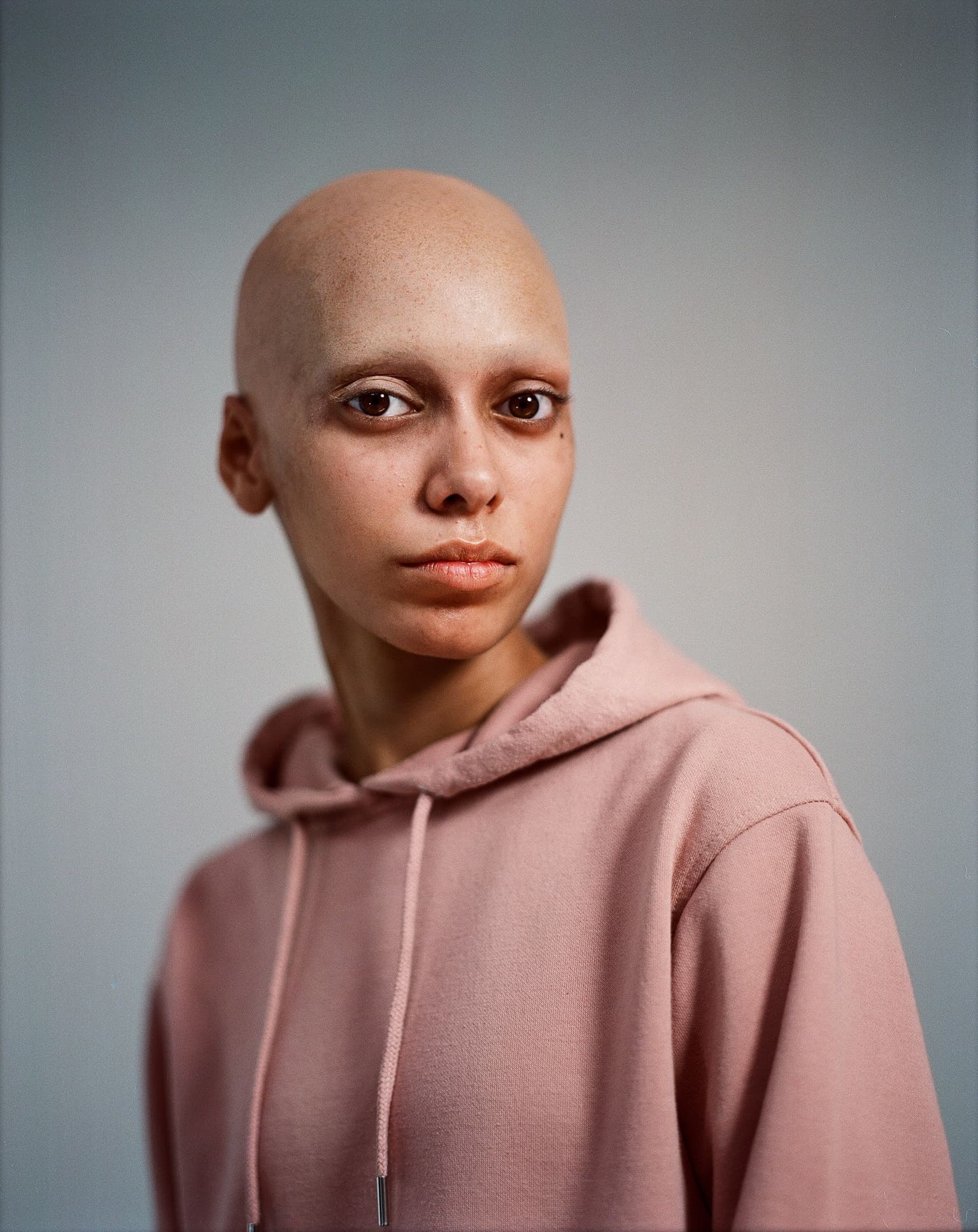 young woman with bald cap