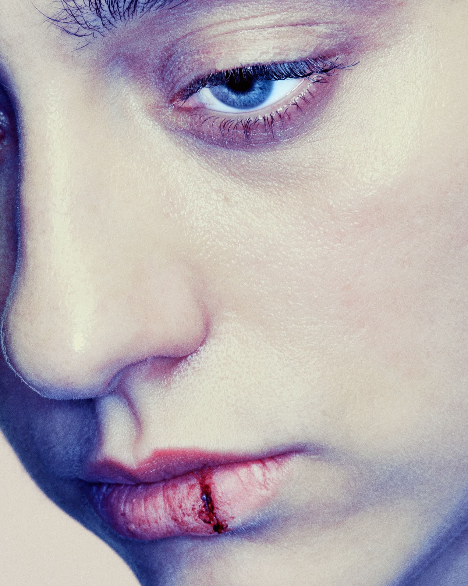 Close up of a split lip on a womans face